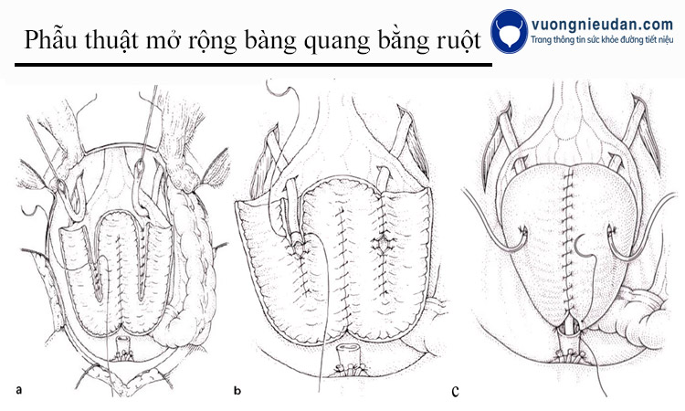 Phẫu thuật 1