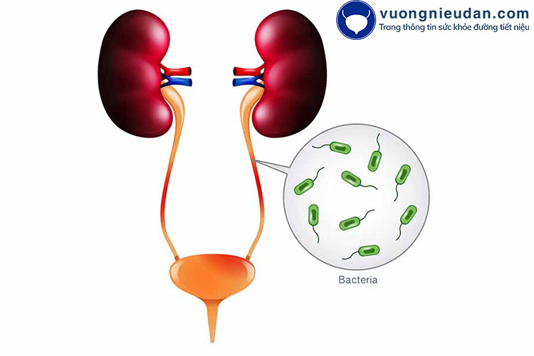 Nhiễm khuẩn tiết niệu 1