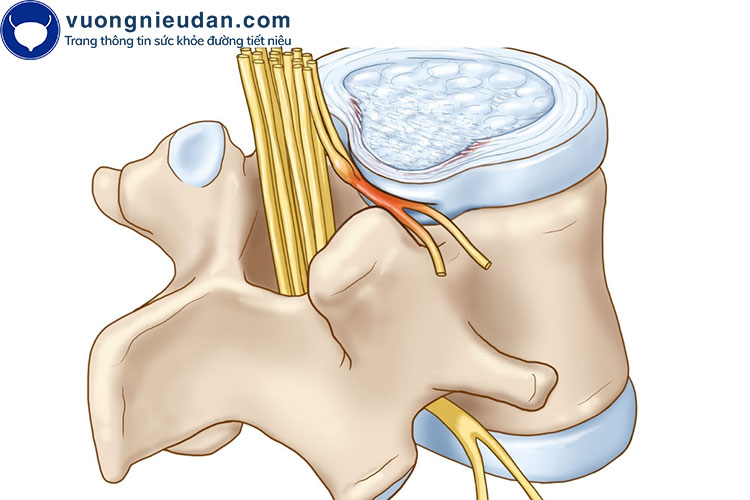 Cơ trơn bàng quang giảm hoạt 1