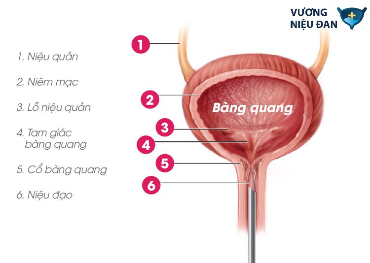 Tình trạng són tiểu, tiểu không tự chủ có thể xảy ra do bàng quang đầy