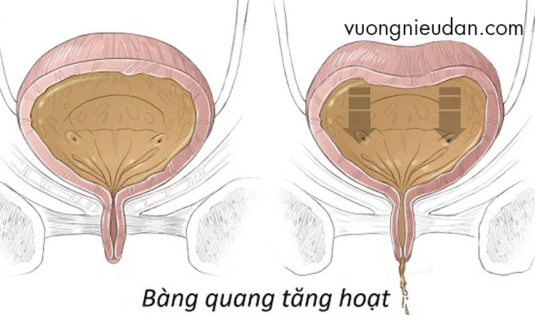 Do bệnh lý 1