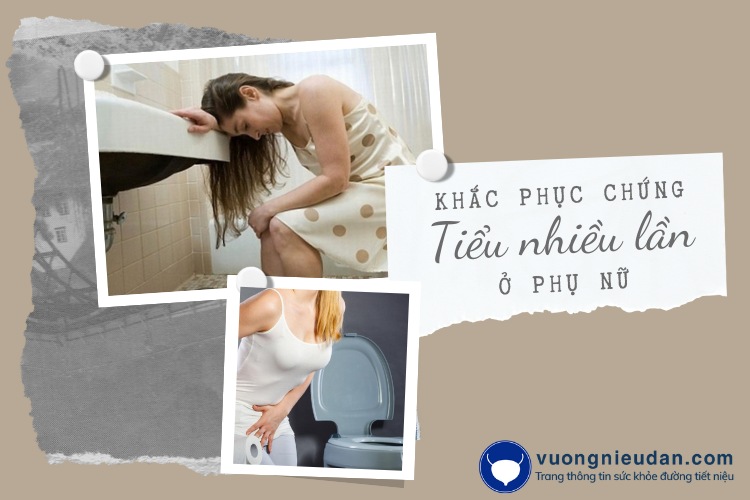 Khắc phục chứng đi tiểu nhiều lần trong ngày ở nữ giới