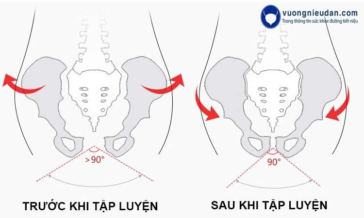 Các bài tập chữa bàng quang tăng hoạt thường là các động tác đơn giản