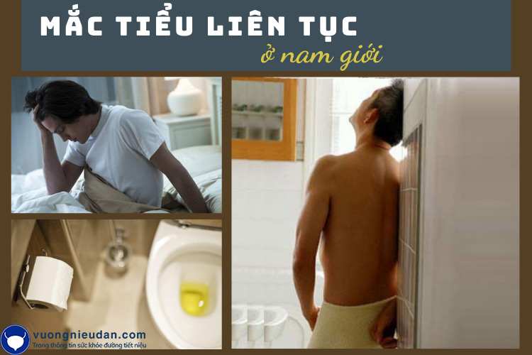 Những điều cần biết về chứng mắc tiểu liên tục ở nam giới