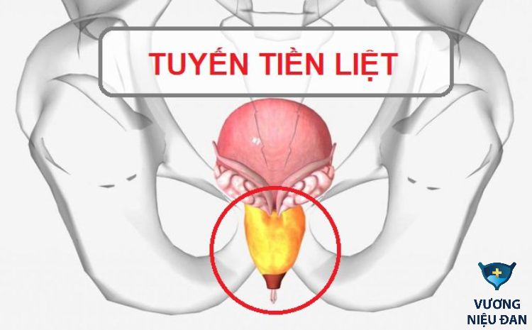 Bệnh về tuyến tiền liệt có thể gây ra chứng tiểu đêm ở người già