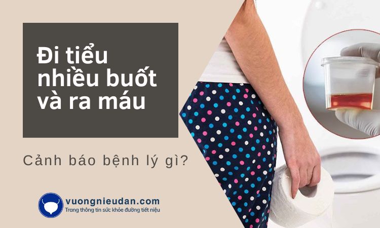 Đi tiểu nhiều buốt và ra máu cảnh báo bệnh lý gì?