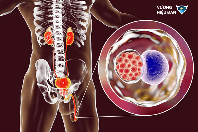 Nhiễm khuẩn đường tiết niệu 