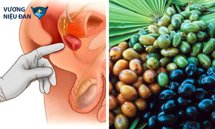 Cọ lùn – “thần dược” hỗ trợ tiểu đêm, tiểu nhiều lần, tiểu không tự chủ