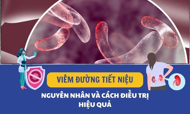 Bệnh viêm đường tiết niệu và những thông tin cần lưu ý