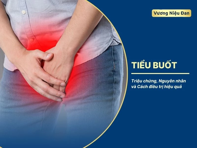 Tiểu Buốt: Triệu chứng, nguyên nhân và cách điều trị hiệu quả
