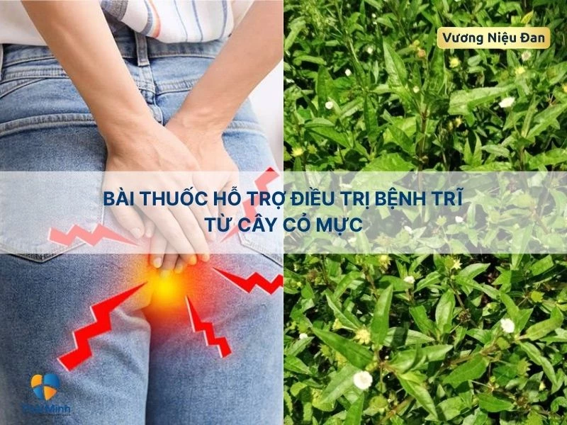 Bài thuốc trị bệnh trĩ với với cây cỏ mực