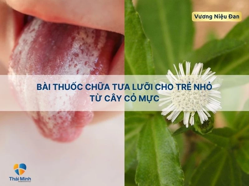 Chữa tưa lưỡi trẻ nhỏ với cây cỏ mực