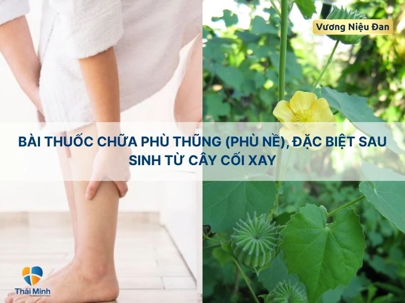 Bài thuốc trị phù nề từ cây cối xay