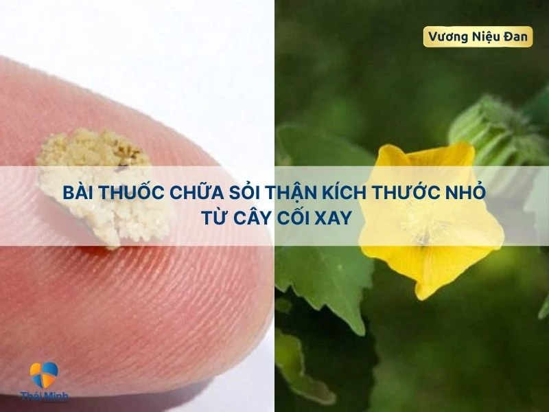 Bài thuốc trị sỏi thận nhỏ từ cây cối xay