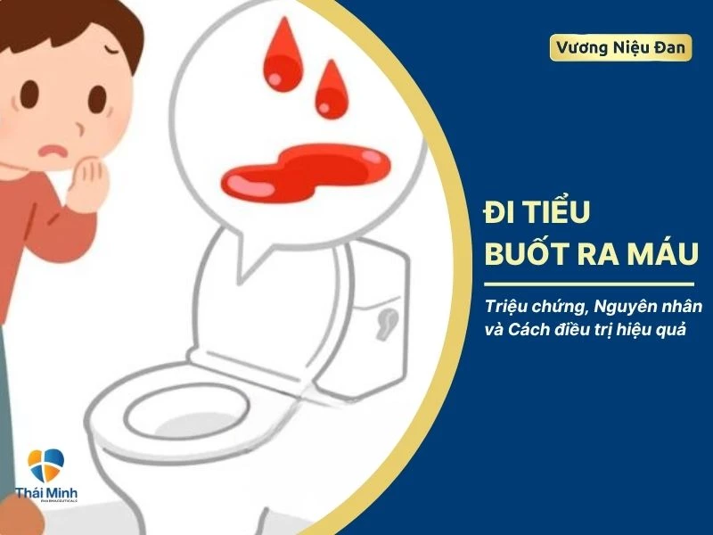 Đi tiểu buốt ra máu: Triệu chứng, Nguyên nhân và Cách điều trị hiệu quả