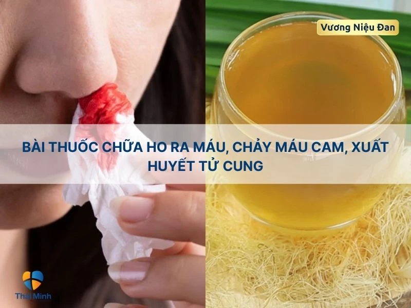 Trị chảy máu cam với râu ngô