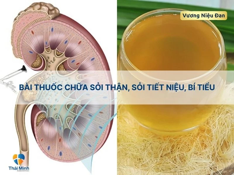 Chữa viêm tiết niệu với râu ngô