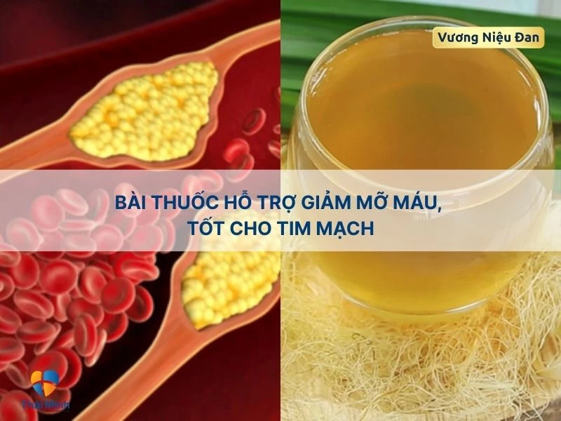 Giảm mỡ máu với râu ngô