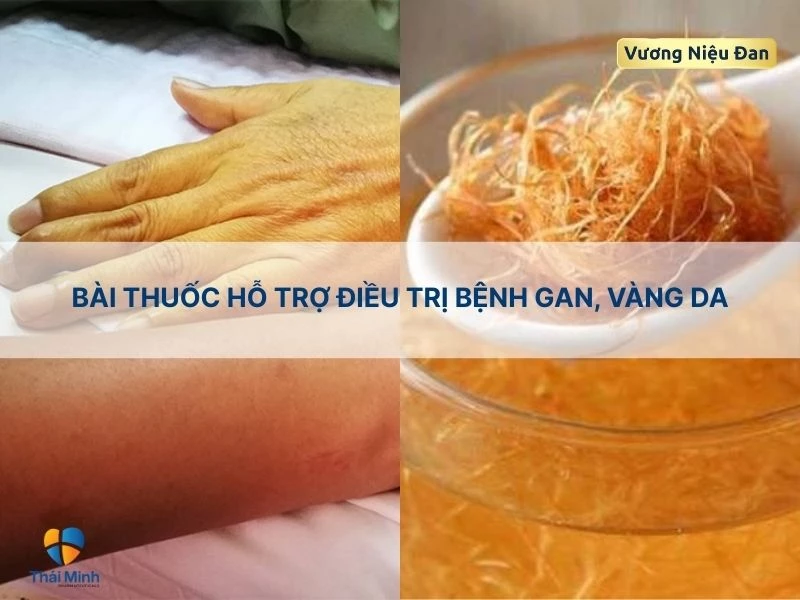 Trị tiểu đường với râu ngô