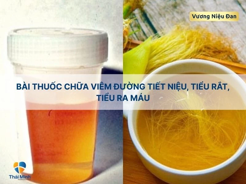 Trị bệnh gan, vàng da với râu ngô